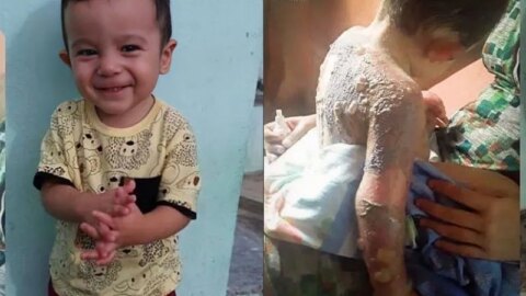 Criança de 1 ano é socorrida de helicóptero após queimaduras com óleo quente, no Vale do Piancó