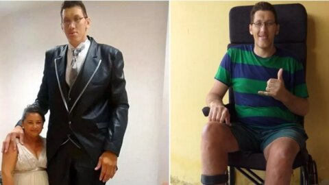 Homem mais alto do Brasil, Ninão vai amputar perna e faz campanha para comprar prótese