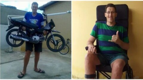 Homem mais alto do Brasil marca cirurgia para amputar perna: ‘melhorar a minha saúde’