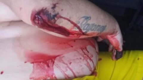 Confusão em Cadeia Pública deixa um detento ferido, em Piancó