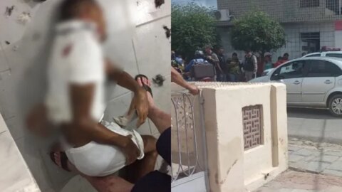 Jovem é baleado e fica em estado grave horas após ser solto de presídio, em Patos
