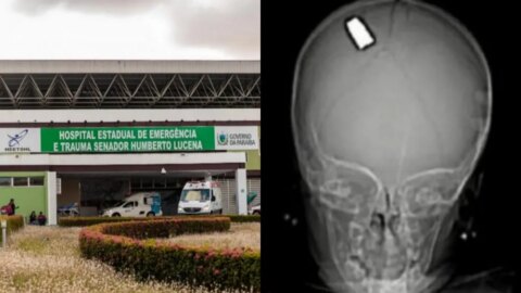 Bebê de um ano baleada na cabeça durante atendado contra pai recebe alta médica, na Paraíba