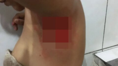 Adolescente é esfaqueada por colega, no Vale do Piancó