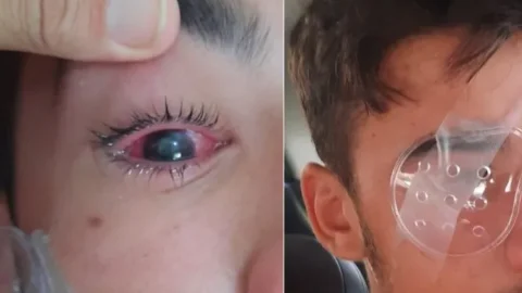 Estudante atingido por fio de internet perde a visão do olho afetado e caso deve parar na Justiça, em Patos