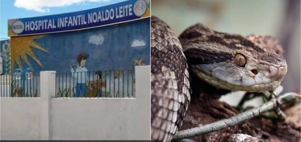 Criança de 4 anos dá entrada no Hospital Infantil de Patos após ter sido picada por cobra Jararaca, em creche