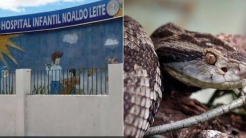 Criança de 4 anos dá entrada no Hospital Infantil de Patos após ter sido picada por cobra Jararaca, em creche