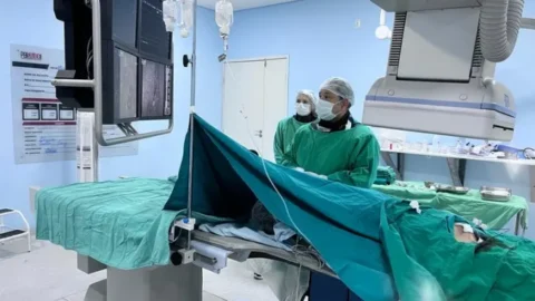 Dispositivo que previne embolia pulmonar é utilizado em procedimento de alta complexidade na hemodinâmica de Patos