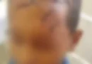 Criança de 8 anos é brutalmente agredida por vizinho com golpes de foice em Piancó-PB
