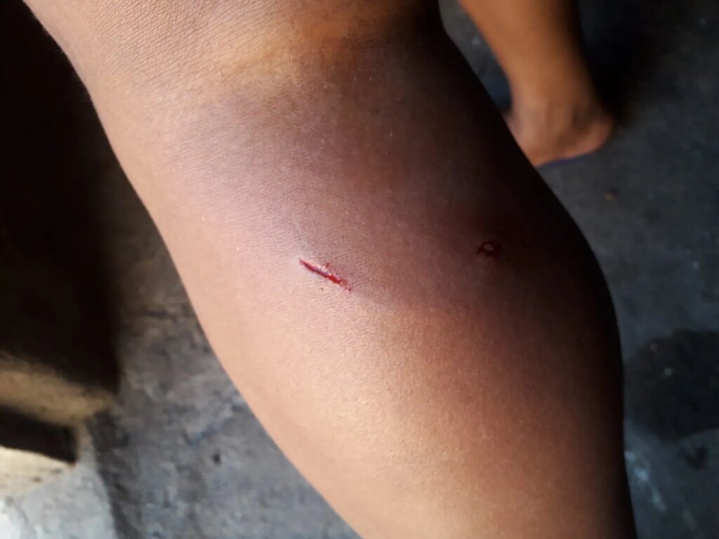 Mulher é atacada por cães em Santa Terezinha; filho pede providências