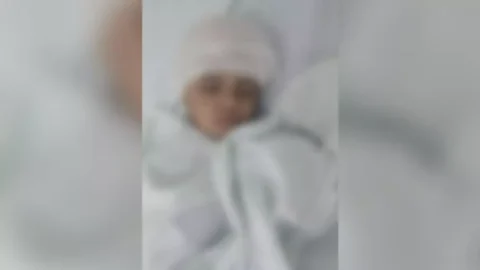 EM PATOS: Criança de três anos sofre cortes profundos e é internada em estado grave após ataque de cachorro